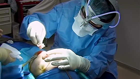 Rhinoplasty surgeon checking the symmetry of the nose.