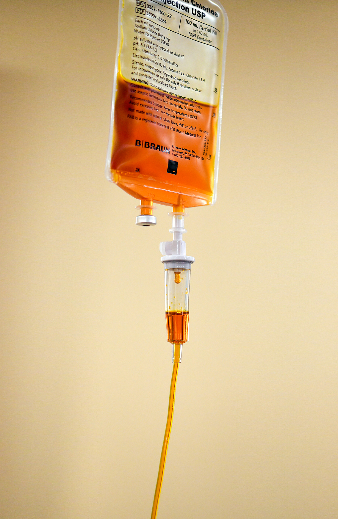 An IV therapy IV bag filled with curcumin.