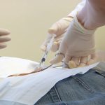 Patient receiving stem cell injections in their back.