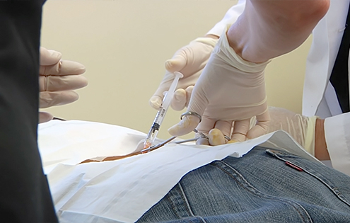 Patient receiving stem cell injections in their back.